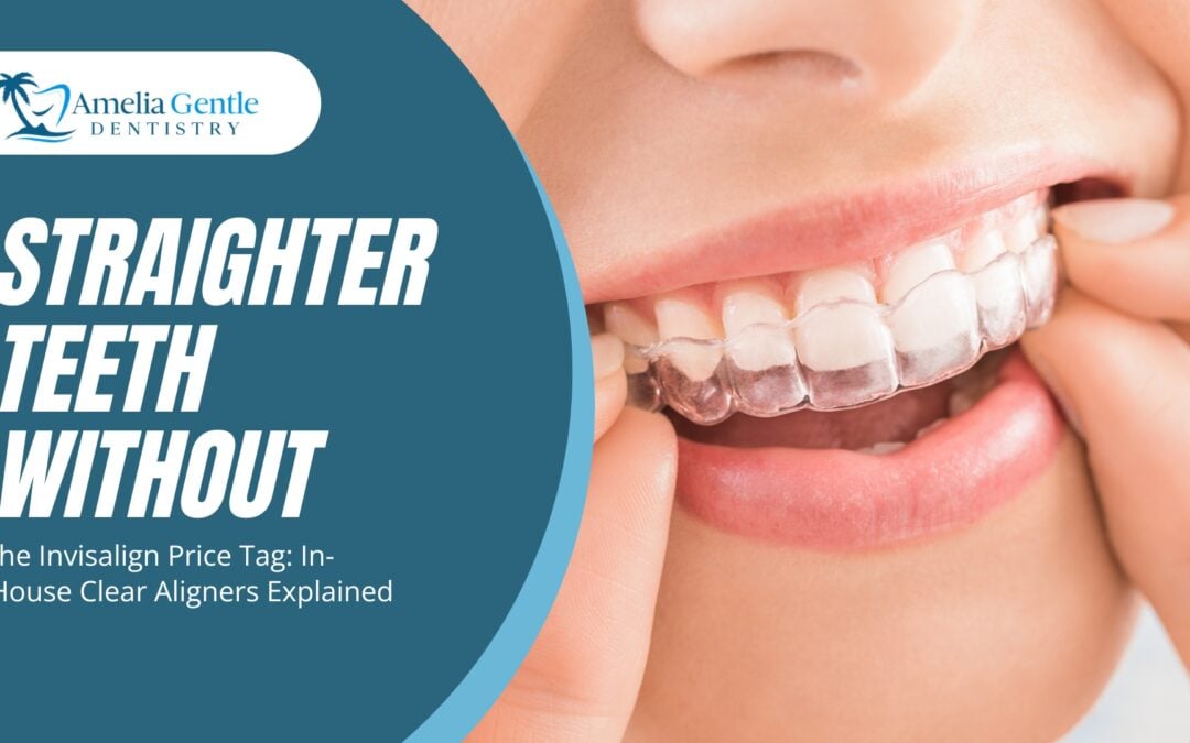 Straighter Teeth Without the Invisalign Price Tag: In-House Clear Aligners Explained