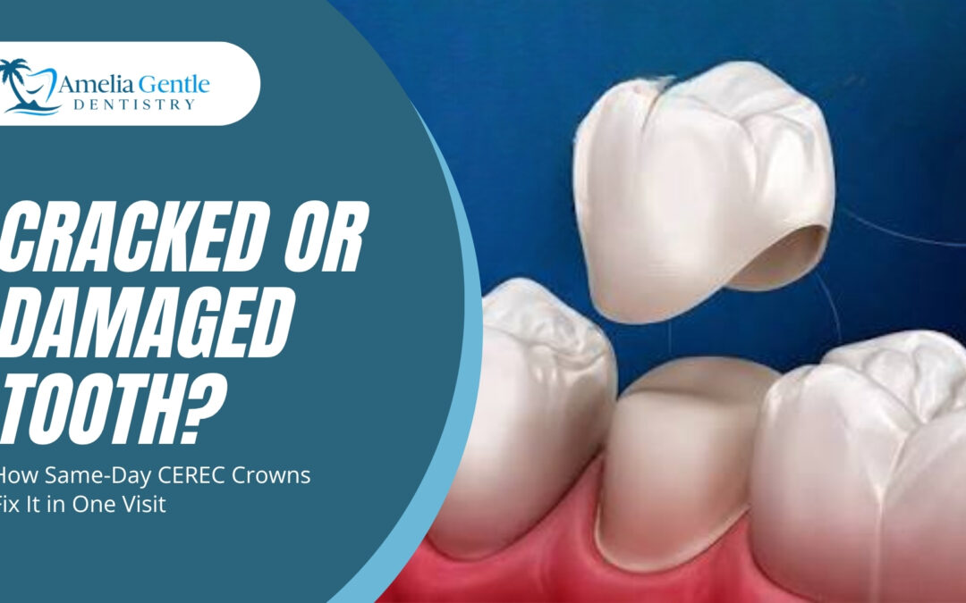Cracked or Damaged Tooth? How Same-Day CEREC Crowns Fix It in One Visit